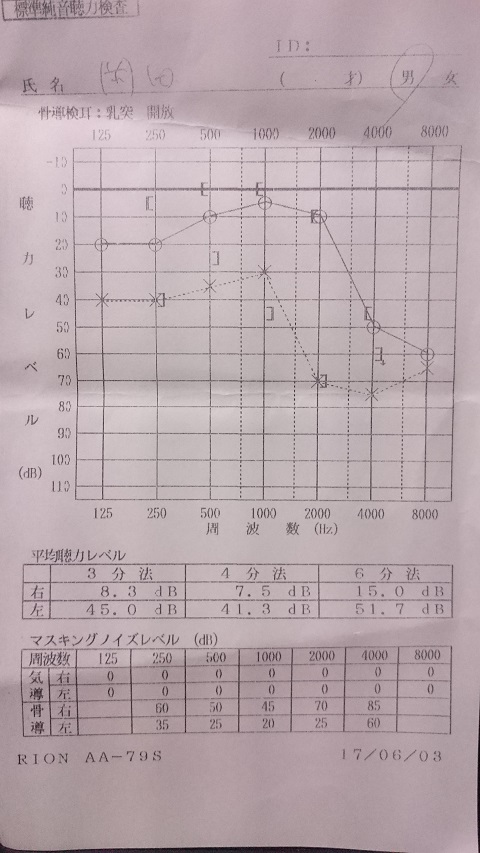 張力レベル - コピー.JPG