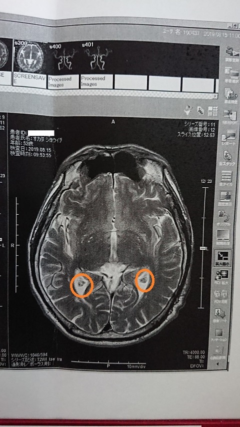 脳神経外科2019-1 - コピー.JPG