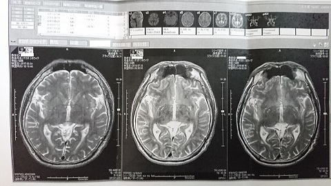 脳神経外科2019-2 - コピー.JPG
